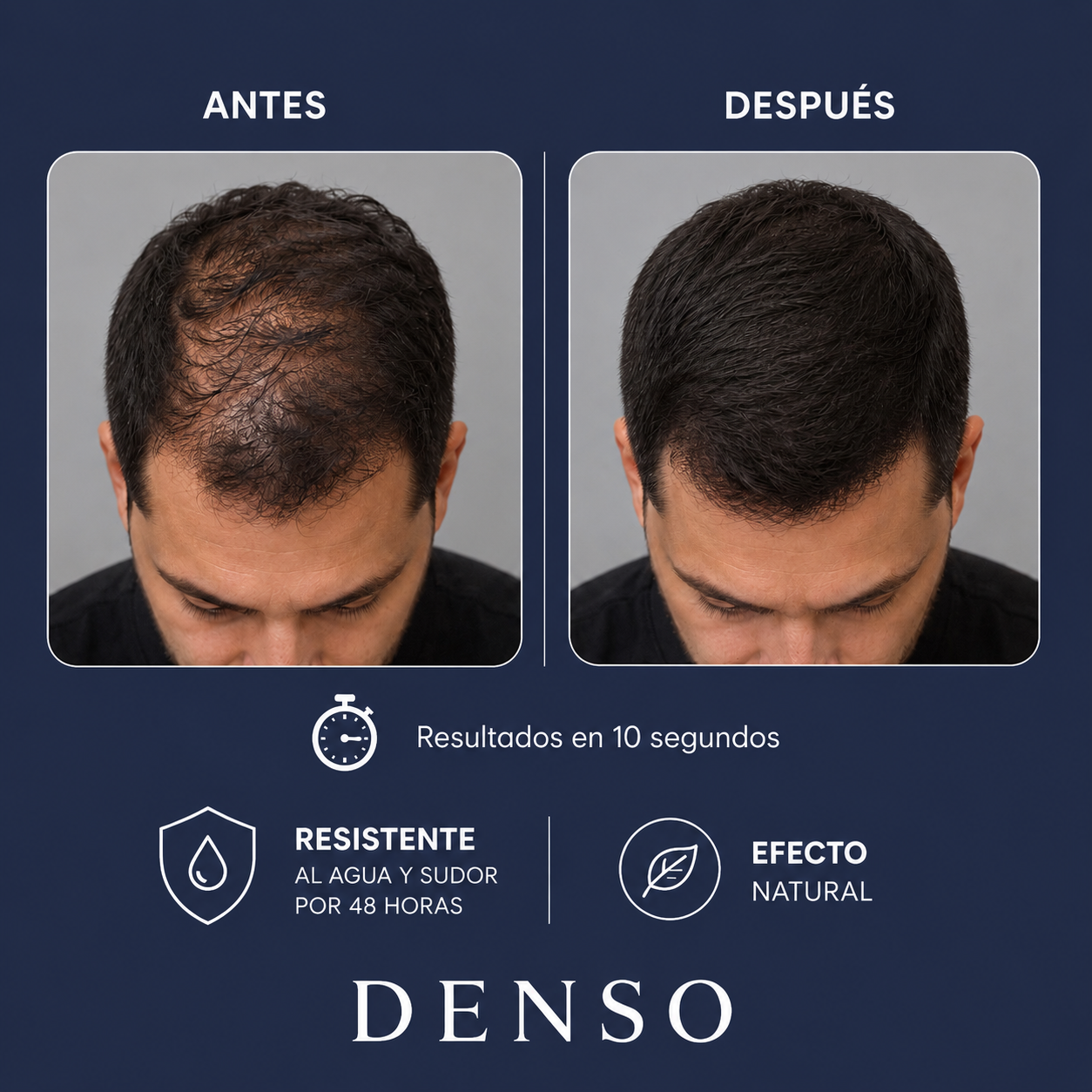 Denso™ aumenta tu confianza y densidad capilar