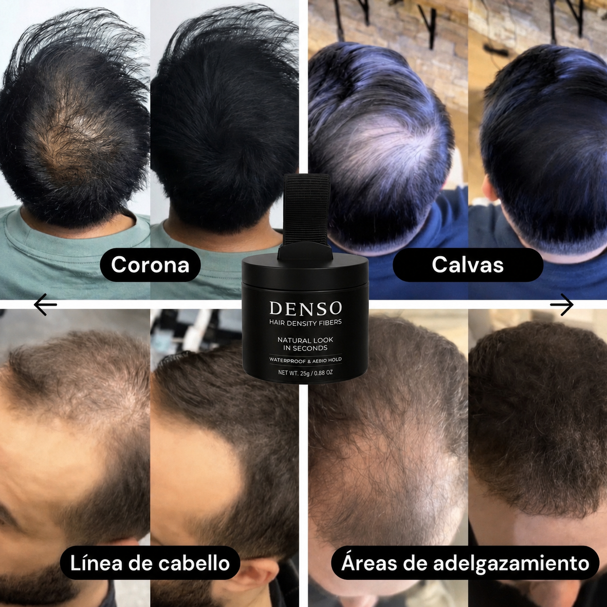 Denso™ aumenta tu confianza y densidad capilar