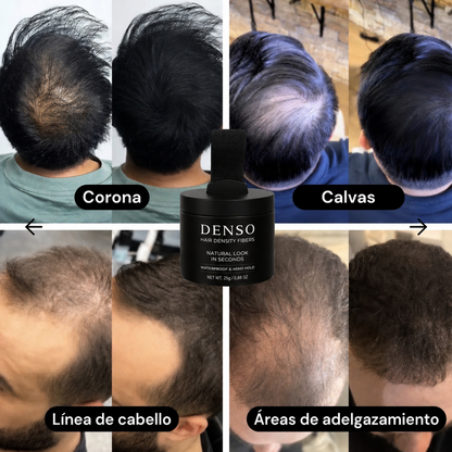 Denso™ aumenta tu confianza y densidad capilar
